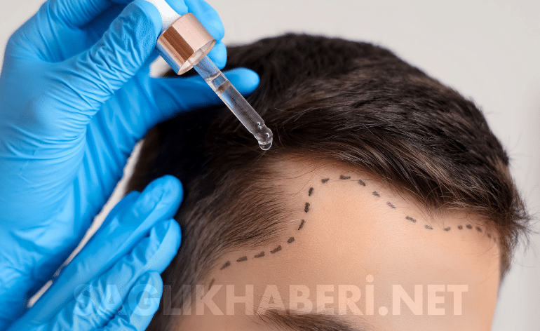 Sağlık Bakanlığı’ndan Saç Ekimi Kararı: 4 Sağlık Branşına Sertifika Müjdesi! • Sağlık Haberi